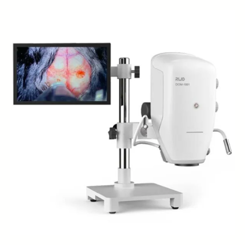 Digital Microscope (수술용 디지털 현미경)